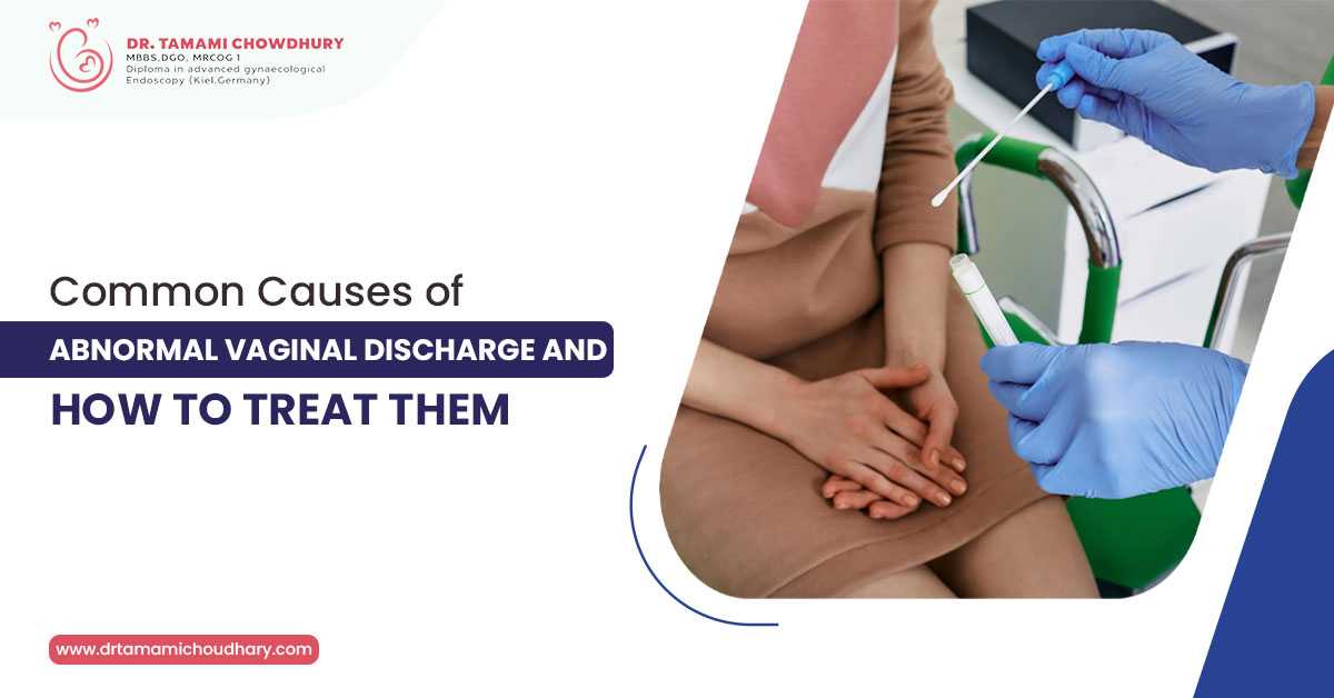 Common Causes of Abnormal Vaginal Discharge and How to Treat Them