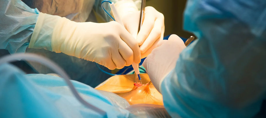 Gynae Laparoscopic Surgeon in Siliguri